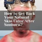 How to Get Back Your Natural Skin Color After Sunburn thevenusface