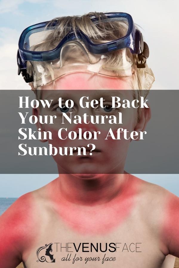 How to Get Back Your Natural Skin Color After Sunburn thevenusface