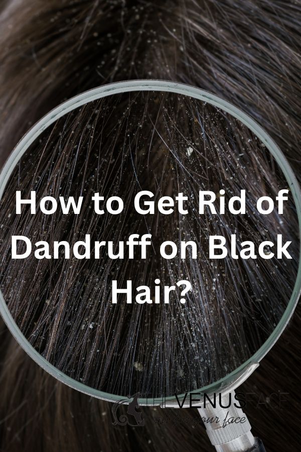 How to get rid of dandruff on black hair 3 thevenusface