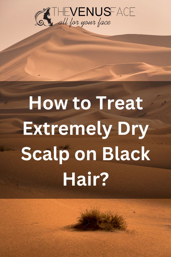 How to Treat Extremely Dry Scalp on Black Hair thevenusface